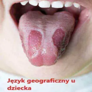 Język geograficzny u dziecka