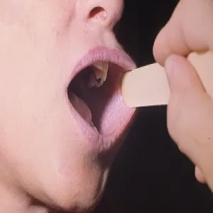 Jama ustna zmiany chorobowe liszaj płaski