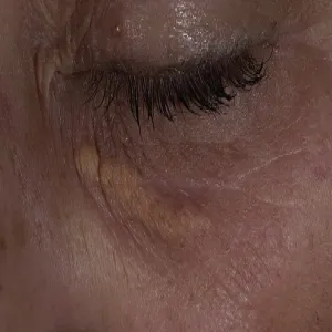 Kępki żółte zdjęcia 