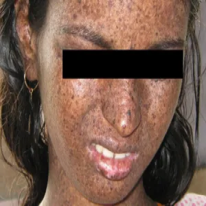 Skóra pergaminowa zdjęcia