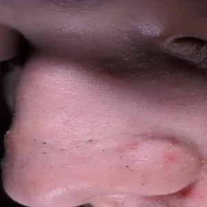 Zaskórniki otwarte brązowe lub czarne kropki