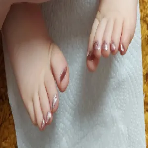 koilonychia u niemowlaka