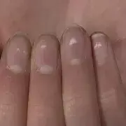 Zmiany na paznokciach białe kropki