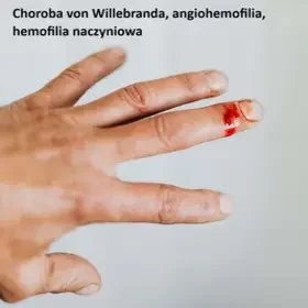 Choroba von Willebranda, angiohemofilia, hemofilia naczyniowa 