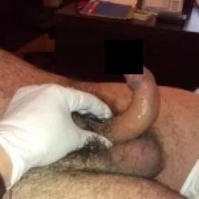 Choroby prącia choroba Peyroniego