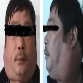 Choroby twarzy i szyi 