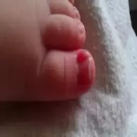 Czerwony paluszek przy paznokciu u niemowlaka