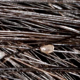 Gnida na włosach zdjęcie