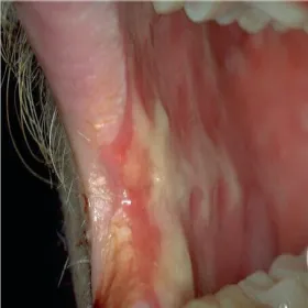 Jama ustna zespół Stevensa- Johnsona