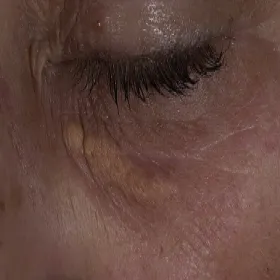 Kępki żółte zdjęcia 