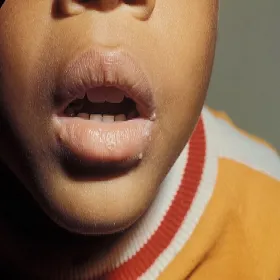 Mięczak zakaźny na ustach