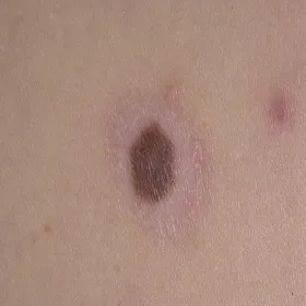 Pieprzyk z obwódka