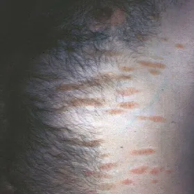 Przyłuszczyca zdjęcie