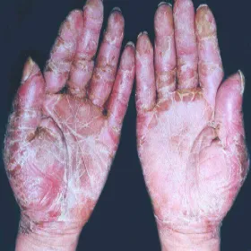 Rumień Lombardzki zdjęcie