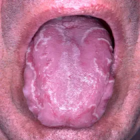 Stan na języku zwany język geograficzny