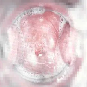 Upławy pieniste i o przykrym zapachu 