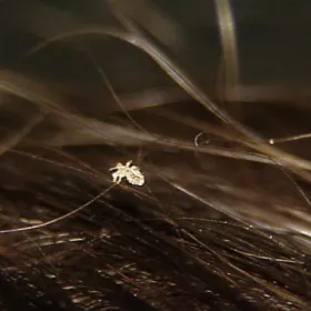 Wesz na włosach zdjęcie