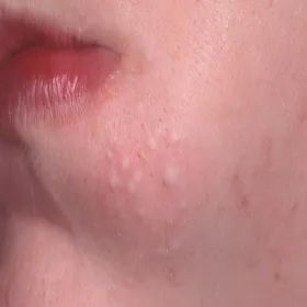 Zaskórniki zamknięte zdjęcie