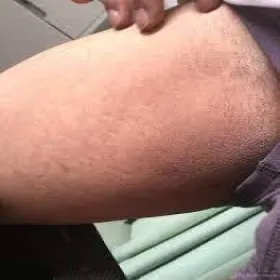 ciemna skóra pachwin