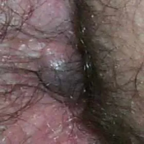 guzek przy odbycie zdjęcia