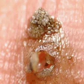 inwazja pchły piaskowej 