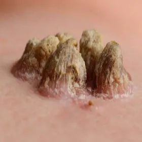 niewielki wzrost skóry