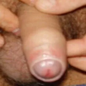 stulejka jak wygląda