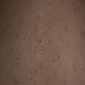 zaskórniki otwarte zdjęcie